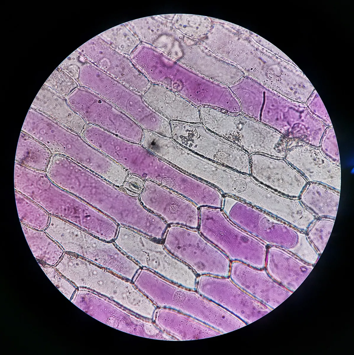 Plasmolysis in red onion cells seen under a light microscope, membranes pulling away from the cell walls